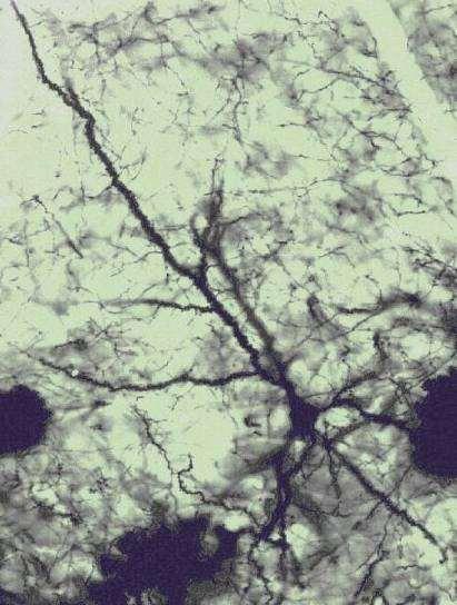 Golgi-féle Ag-impregnáció ezüst-nitrát kálium-dikromáttal reagál, az ezüst-kromát szemcsék pedig lecsapódnak az idegsejt membránján a neuronok és a gliasejtek is
