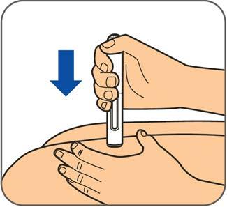 4. lépés: Finoman nyújtsa ki a bőrt az injekció beadására kiválasztott, megtisztított helyen. Tartsa az előretöltött injekciós tollat 90 fokos szögben a bőrre.