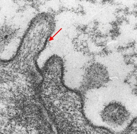 integráns membránfehérjékhez (glikoproteidek) vagy lipidekhez (glikolipidek) kapcsolódnak Mechanikai és kémiai védelem Negatív töltése miatt