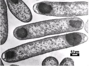 212 Fermentációs feldolgozási műveletek 6. ZÁRVÁNYTESTEK FELDOLGOZÁSA 6.1. A zárványtestek A zárványtest kifejezést az angol inclusion body szókapcsolat fordításaként használjuk.