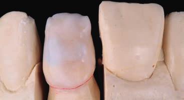 ábra: A Shade BaseStain rétegzése.