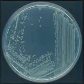 Pseudomonas sp. A Pseudomonas sp.