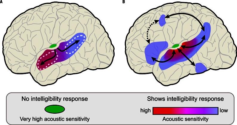 A Broca - Wernicke modellen túl: konceptuális vs.