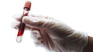 A SZŐRİVIZSGÁLATI TESZTEKKEL SZEMBEN TÁMASZTOTT KÖVETELMÉNYEK: reproduktivitás validitás (a teszt azon képessége, hogy mennyire tudja