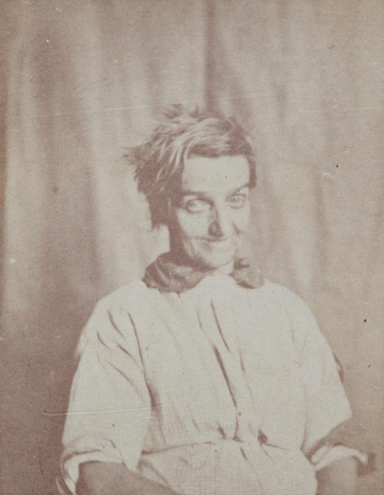 Dr. H. W. Diamond: Egy női elmegyógyintézet lakói (1848-1858) Fotó: Dr. Hugh Welch Diamond: Surrey Megyei Elmegyógyintézet női osztályának betege, c.