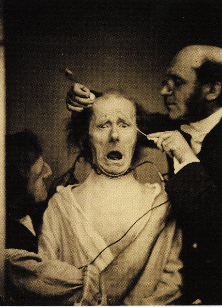 Duchenne, a fényképező orvos kísérletei (1852-1862) A fényképezés feltalálása után eltelt másfél évtizedben már megszaporodtak a fotografálás alkalmazási területei.