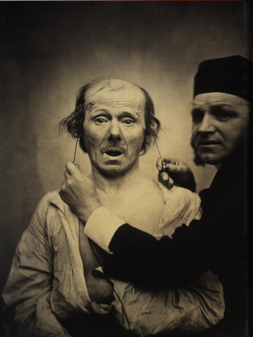 Duchenne, a fényképező orvos kísérletei (1852-1862) Fotó: Duchenne de Boulogne: Orvosi kísérletek, 1852-1862 Várható volt, hogy előbbutóbb az orvostudomány is megpróbálja felhasználni a fényképezés