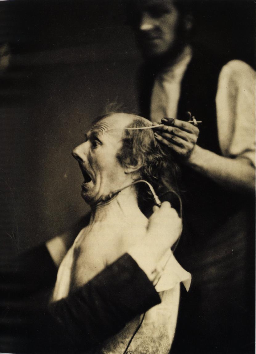 Duchenne, a fényképező orvos kísérletei (1852-1862) Az 1806-ban született Douchenne de Boulogne húsz éves korában kezdte el orvosi tanulmányait.