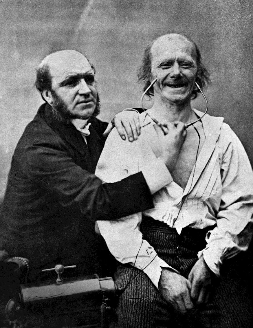 Duchenne, a fényképező orvos kísérletei (1852-1862) Fotó: Duchenne de Boulogne: Orvosi kísérletek, 1852-1862 Az izmok ingerlésére kettő vagy négy elektródát használt, a szükséges áramot pedig egy, a