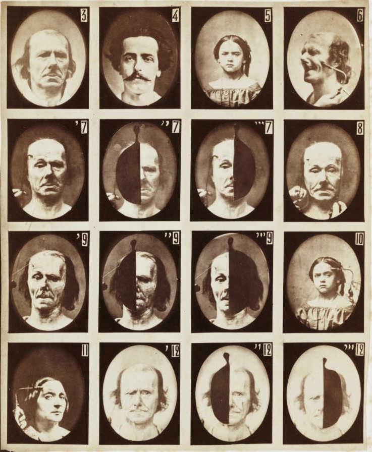 Duchenne, a fényképező orvos kísérletei (1852-1862) A képeket valószínűleg több helyszínen készítette, de a történészek beszámoló alapján biztosan dolgozott a lakásán is, ahol egy laboratóriumot