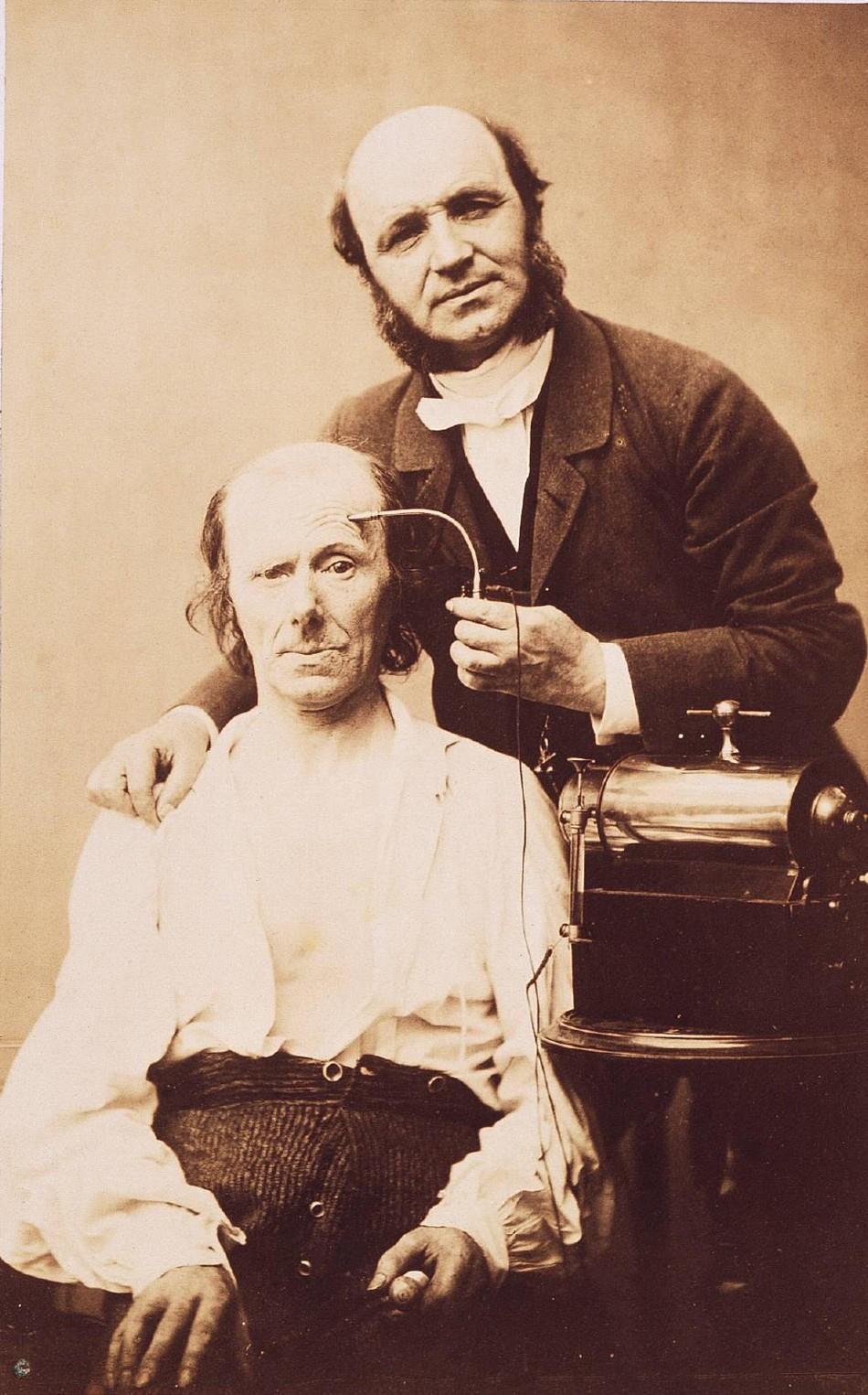 Duchenne, a fényképező orvos kísérletei (1852-1862)