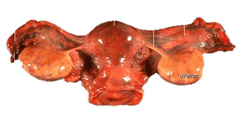 A petefészek felépítése A petefészkek a medencében elhelyezkedő páros szervek, alakjuk és nagyságuk mandulára emlékeztető.