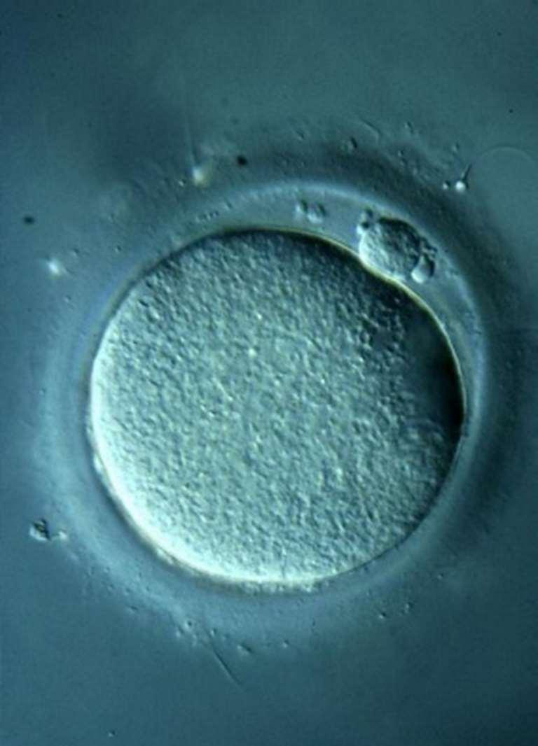 oocytává) alakul. Az érett petesejt (II. r. oocyta) kilökődik a petefészek felszínéről (ovuláció), és alkalmassá válik a megtermékenyítésre.