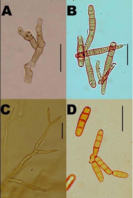 EREDMÉNYEK ÉS MEGVITATÁS 41. ábra. A Dendryphion penicillatum (Corda) Fr. mák levelén fejl dött konídiumtartója (A) és konídiumai (B), mák magvakon fejl dött konídiumtartója (C) és konídiumai (D).