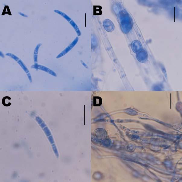 EREDMÉNYEK ÉS MEGVITATÁS 48. ábra. AFusarium oxysporum Schlechtend.:Fr. festett makrokonídiumai (A) és klamidospórái (B). F. oxysporum Schlechtend.:Fr. f. sp. basilici (Dzidzariya) G.M. Armstr.