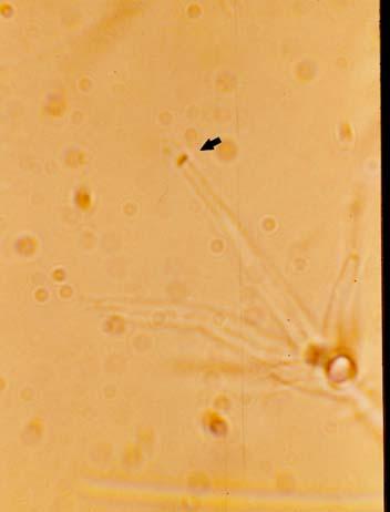 MELLÉLET III 9. ábra. AVerticillium dahliae Kleb.