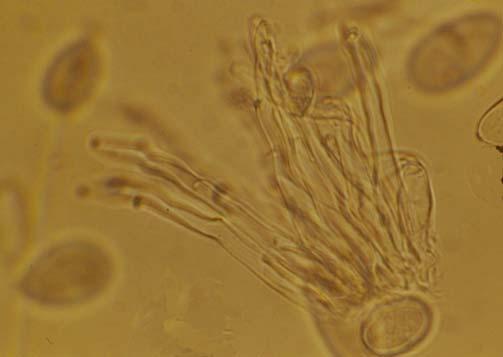 ábra. ARamularia rubella (Bonord.) Nannf. konídiumtartó kötege.