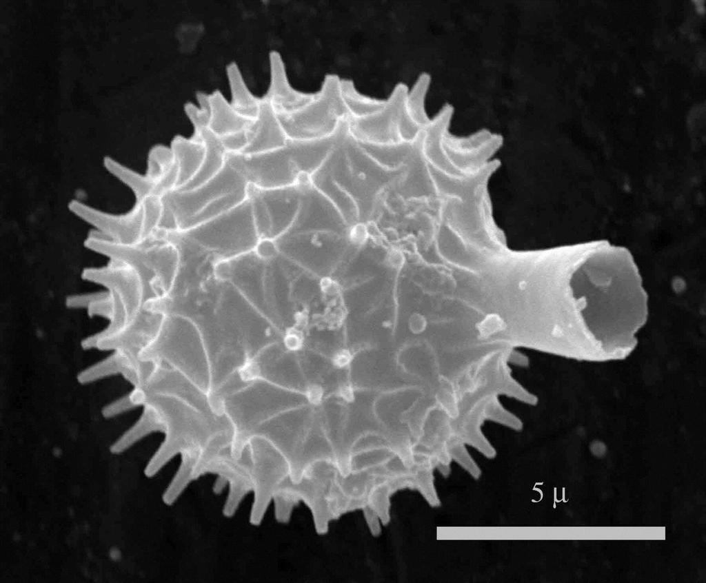 1.3.2.1. Chrysophyceae ciszták 3. ábra. Chrysophyta ciszta a Galesből. A tavi üledékékben a sztomatociszták gyakran, olykor tömegesen megtalálható mikrofosszíliák (3. ábra).