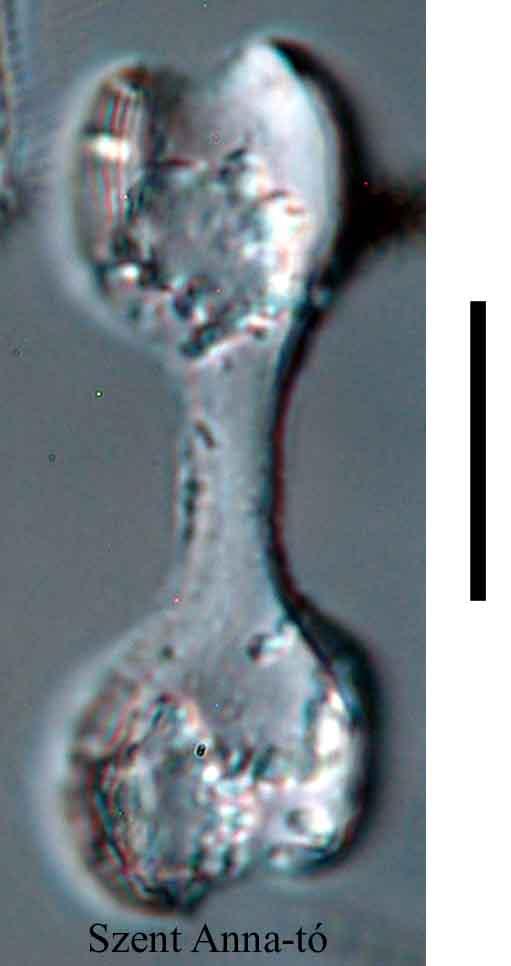 5. ábra. Fitolit (skála: 10 µm) A kovapreparátumokon is jól felismerhetőek és tanulmányozhatóak, igaz, általában nincs statisztikailag feldolgozható mennyiség belőlük egy-egy lemezen.