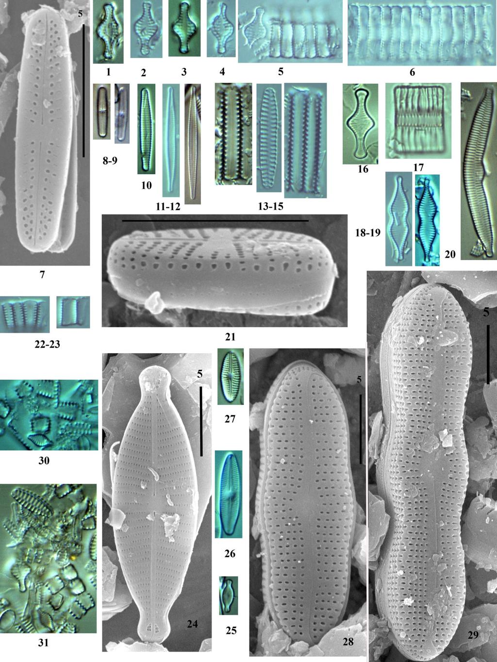 65. ábra. A Páreng-hegység jellemző kovaalgái. 1-6. Pseudostaurosira pseudoconstruens 7-9. Achnanthidium lineare 10. Stauroforma exiguiformis 11-12. Fragilaria gracilis 13-15. Staurosirella n. sp.