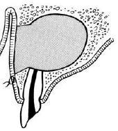 SURGICAL MANAGEMENT OF CYSTS 1.