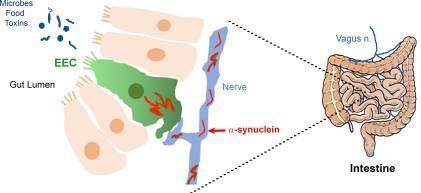 Kóros α-synuclein keletkezése (duális hipotézis) Virus infekció Mikróbák toxinok Bél endokrin sejtjei bél -lumen szagló rendszer