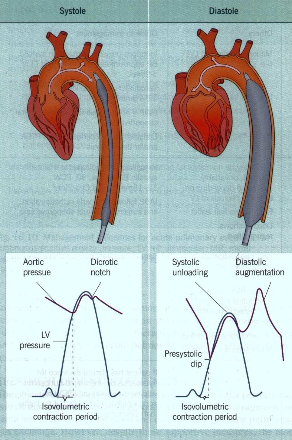 Shock Artériás középnyomás < 65 Hgmm > Szívelégtelenség Inodilatátorok (dobutamin, levosimendan) Inokonstriktorok (dopamin, noradrenalin) mechanikus keringéstámogatás