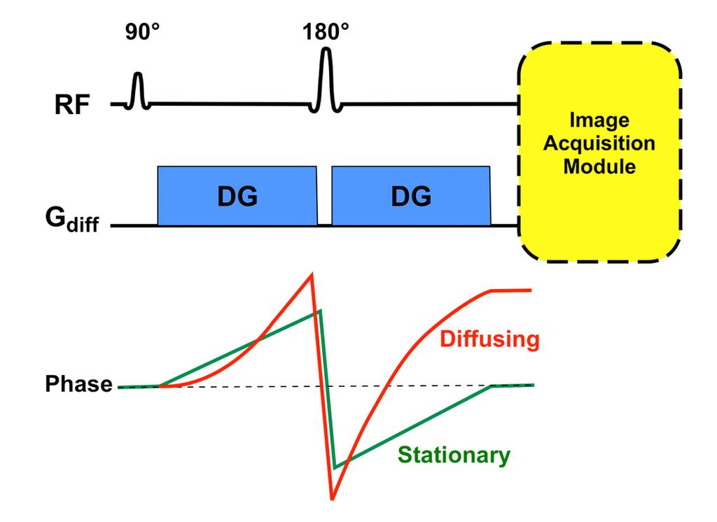 A két DWI technika közti különbség Kiolvasási fázis, mely lehet: Echo planar imaging (EPI) turbo spin echo (TSE) EPI technika: - általános DWI technika - gyorsabb - GRE jellemzők - rel.