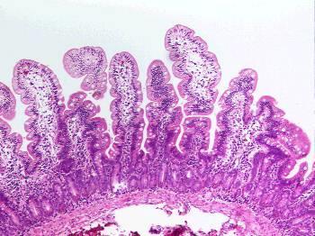 Endoscopias biopszia