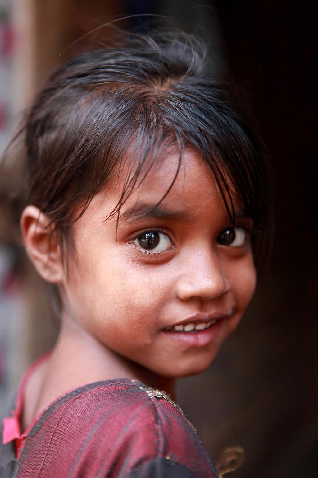 5 éves indiai kislány, arcán a