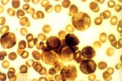 CITOKÉMIAI REAKCIÓK Mieloperoxidáz Sudan Black Specifikus