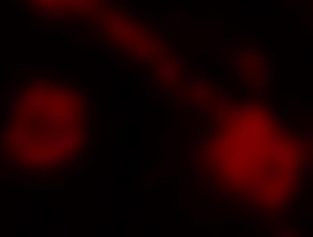 Wide-field STORM imaging