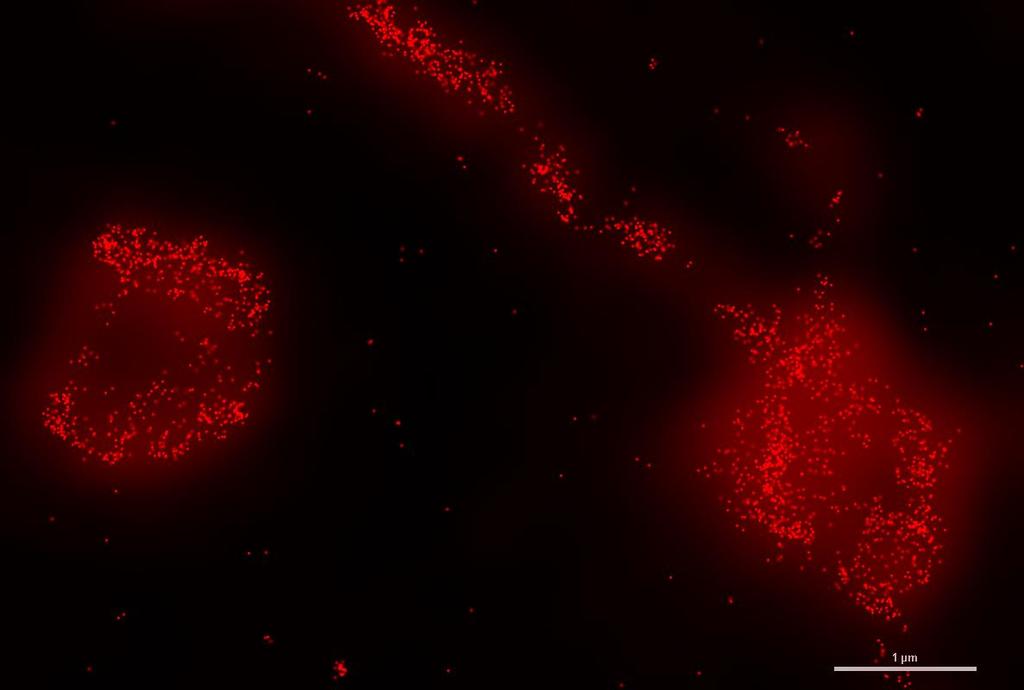 epifluorescence and imaging