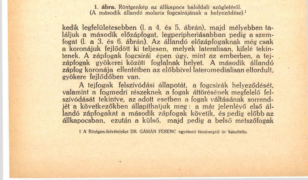 132 A fogazat fejlődőben van, a fogív összenyomott, ypsiloid formájú.