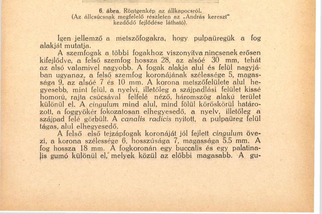 137 dialis széle lekerekített. A korona pars ligualisán a tuberculum kivehető, a foggyökér egyenes hegyben végződik. A külső felső metszőfogak az egész tejfogazatban a legkisebbek, a fog hossza 11 mm.