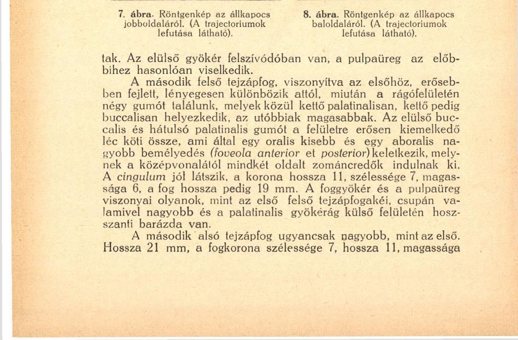 138 mók bemélyedést foglalnak körül, melynek közepéből faágszerűen szétfutó redők indulnak ki. A koronán a tuberculum molare (ZUCKERKANDL) vehető észre.