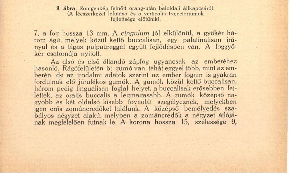 139 tí mm. A rágófelületen öl gumó van, melyek közül keltő buccalisan, kettő lingualisan, egy pedig aboralisan foglal helyet.