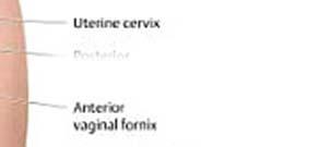 recti tágulat a flexura perinealis