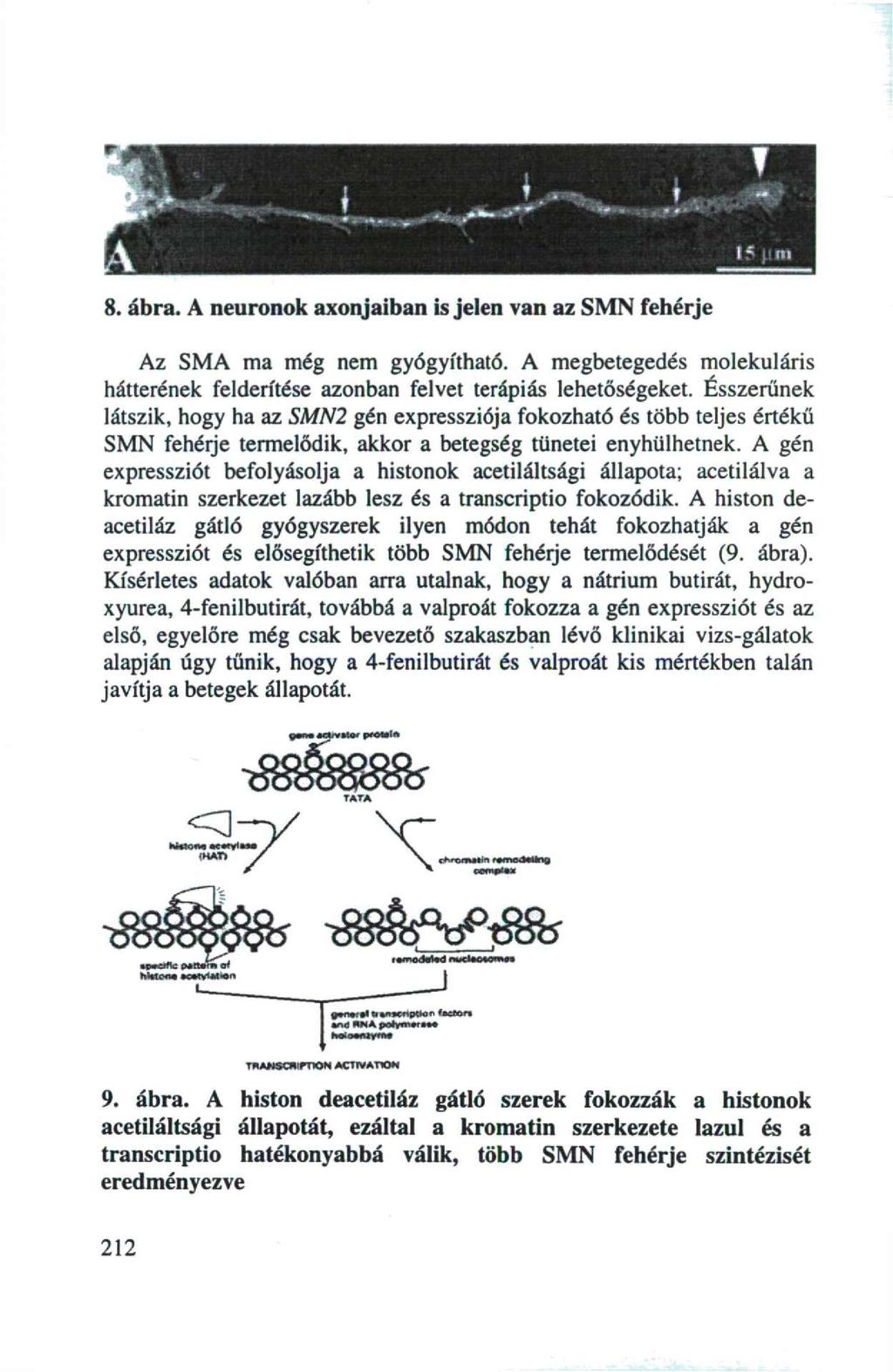 8. ábra. A neuronok axonjaiban is jelen van az SMN fehérje Az SMA ma még nem gyógyítható. A megbetegedés molekuláris hátterének felderítése azonban felvet terápiás lehetőségeket.