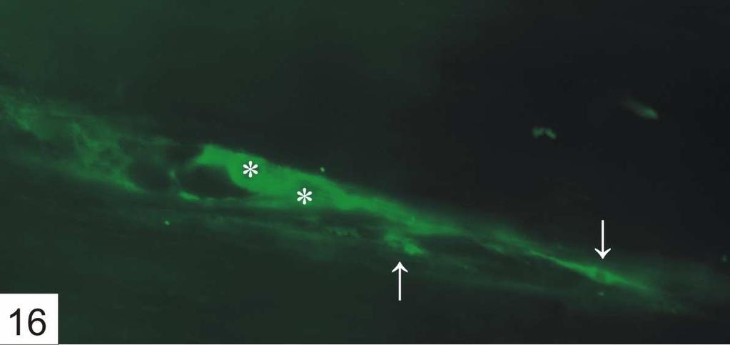 Az NR2A festés nemcsak neuronokat, hanem számos kisebb, a Cajal-féle interstitialis sejtekre emlékeztető sejtet is festett (16.ábra). 15.