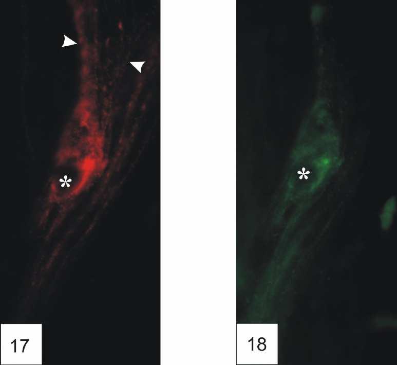 17. ábra VIP-immunpozitív myentericus neuron. Mind a sejttest (csillag), mind a nyúlványok (nyílhegy) intenzív VIP-pozitivitást mutatnak (x670). 18. ábra A 17.