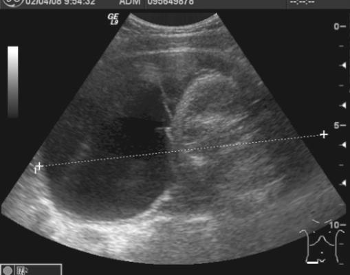 Teratogen tumorok