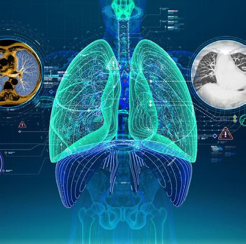 Jelenleg orvosi képmegjelenítő (MRI, CT stb.) platformhoz járulok hozzá a munkámmal. Remek érzés olyan digitális megoldásokhoz hozzájárulni, melyek hatékonyabbá, eredményesebbé teszik a betegellátást.
