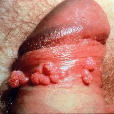 cervicis