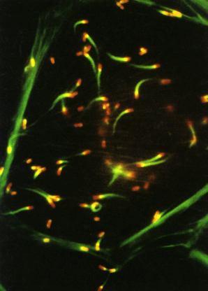Trükkös baktériumok Listeria