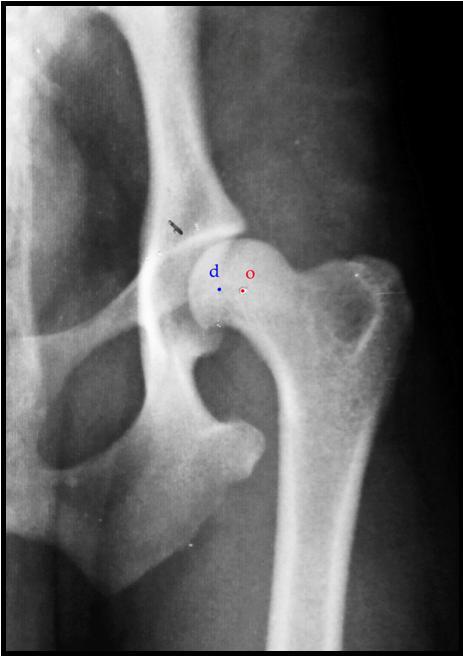 A negyedik felvett adat a dorsalis acetabuláris perem ( d ) és a fej középpont ( o ) távolsága volt (4.