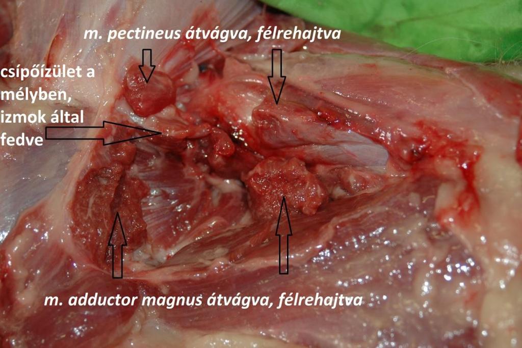 A bal oldali m. adductor magnus és a m.