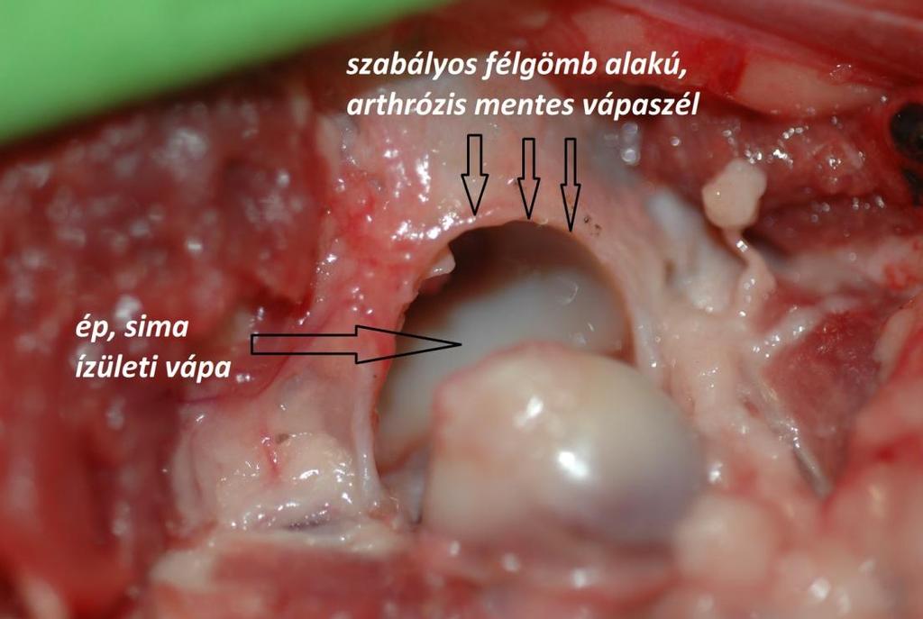 5.A ligamentum teres femoris átvágását követően a combcsont feje kifordítható a vápából, ezáltal nagyobb