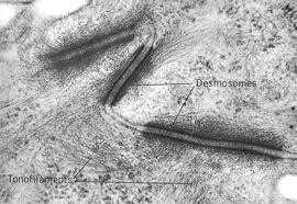 Macula adherens - desmosoma plakk A sejtváz intermedier filamentumaival ( keratin filamentumok) teremt kapcsolatot a szövetben összefüggő hálózat jöhet létre Nem övszerű, hanem