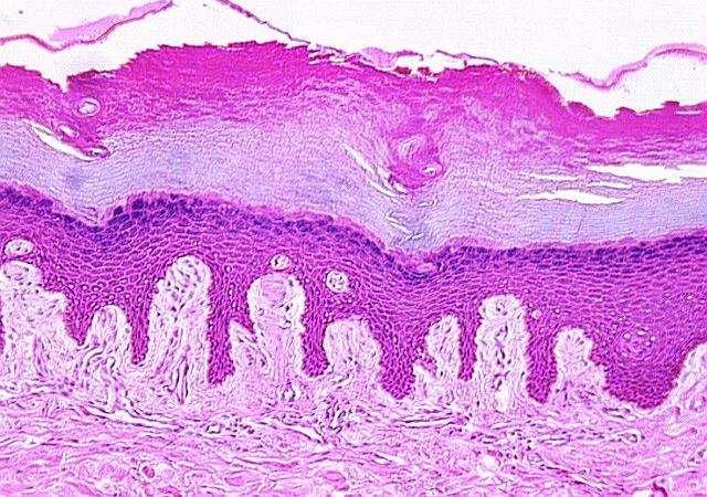 Vastag bőr (tenyér és talp) Str. corneum Str. lucidum 5 2 1 3 4 1.Str. basale / germinativum 2.Stratum spinosum / poligonale 3.Stratum granulosum 4.